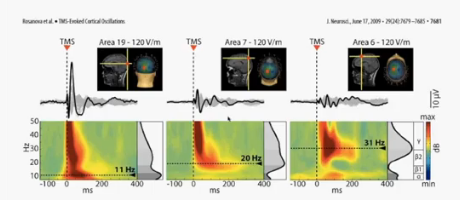 NIH Multimodal Brain Stimulation Speaker Series - Bradley Postle