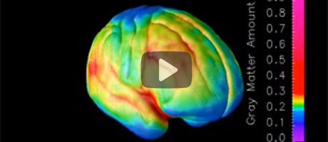 animated video of MRI showing brain maturaion in teen