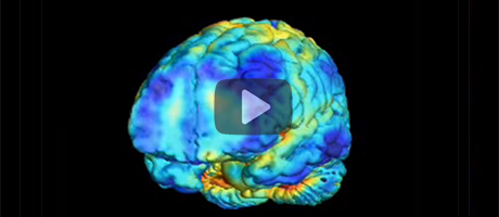 animated video of MRI scna of child with schizophrenia