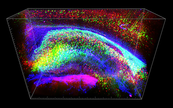 CLARITY 3D view of mouse hippocampus