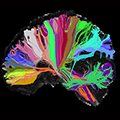high resolution brain scan