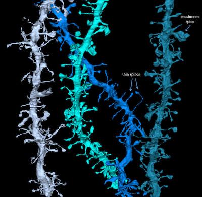 Neural connections form at the tips of brain cell’s branch-like extensions. Such synapses grew during wakefulness and shrank during sleep, likely refreshing learning ability.