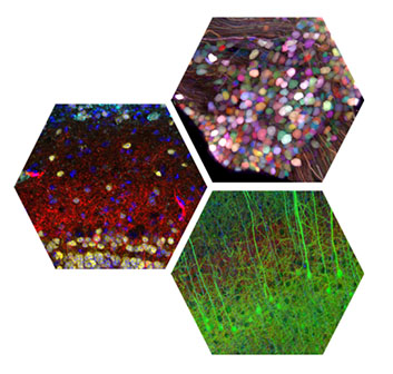 Compilation of three images of cells within the brain